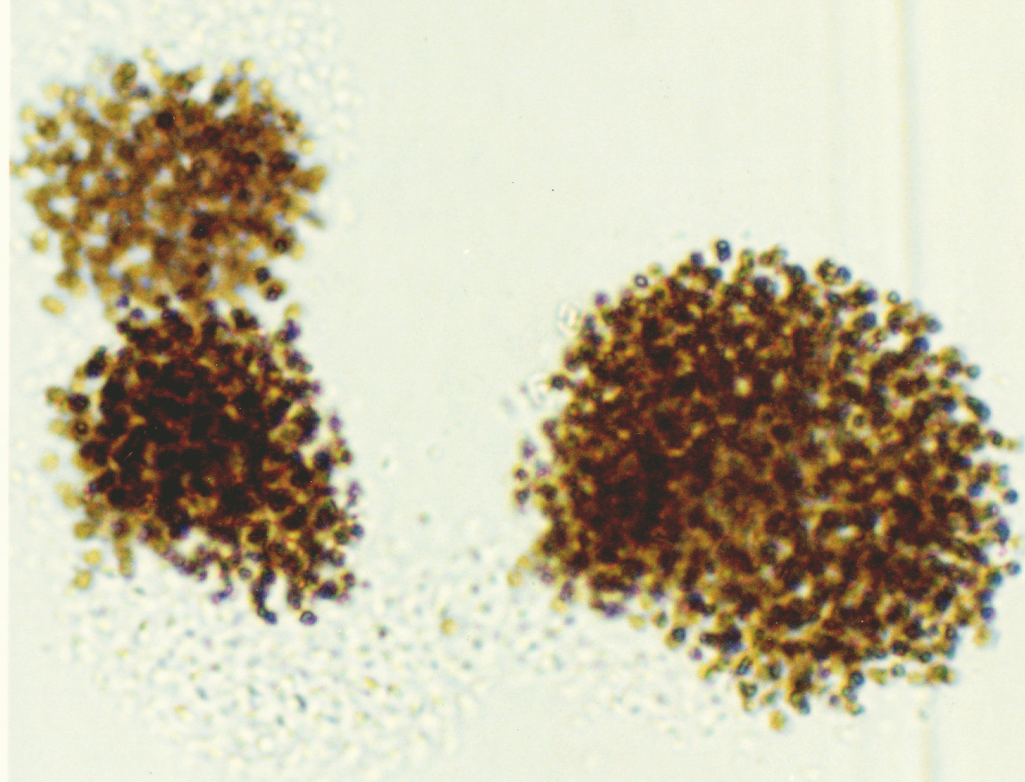 ミクロキスティス エルギノーサ