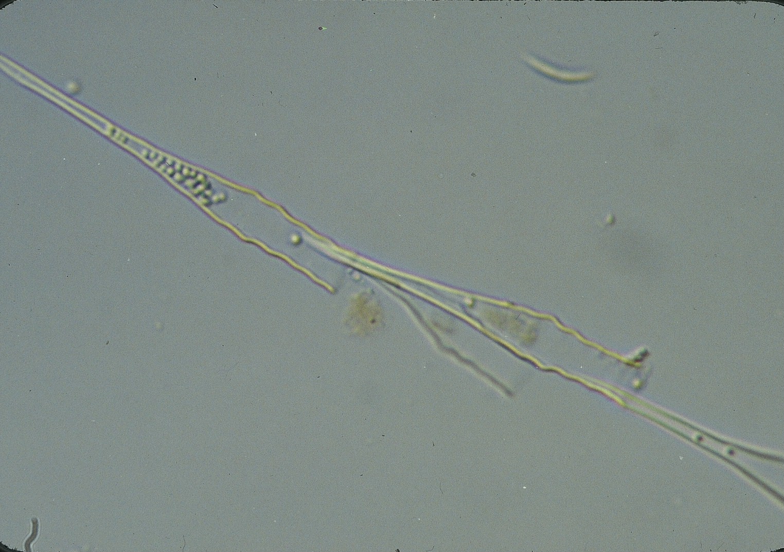 ホソヒダサヤツナギ