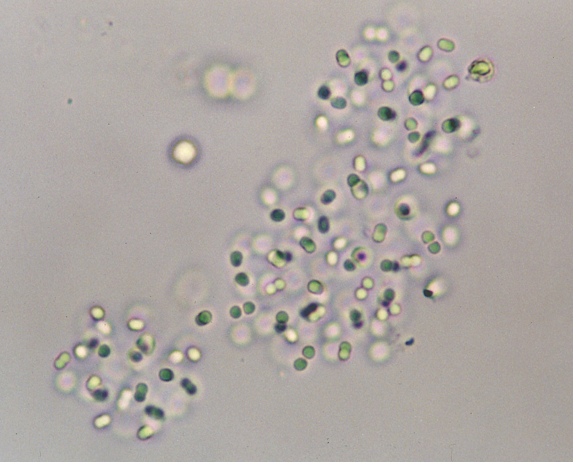 クロオコックス ディスペルサス