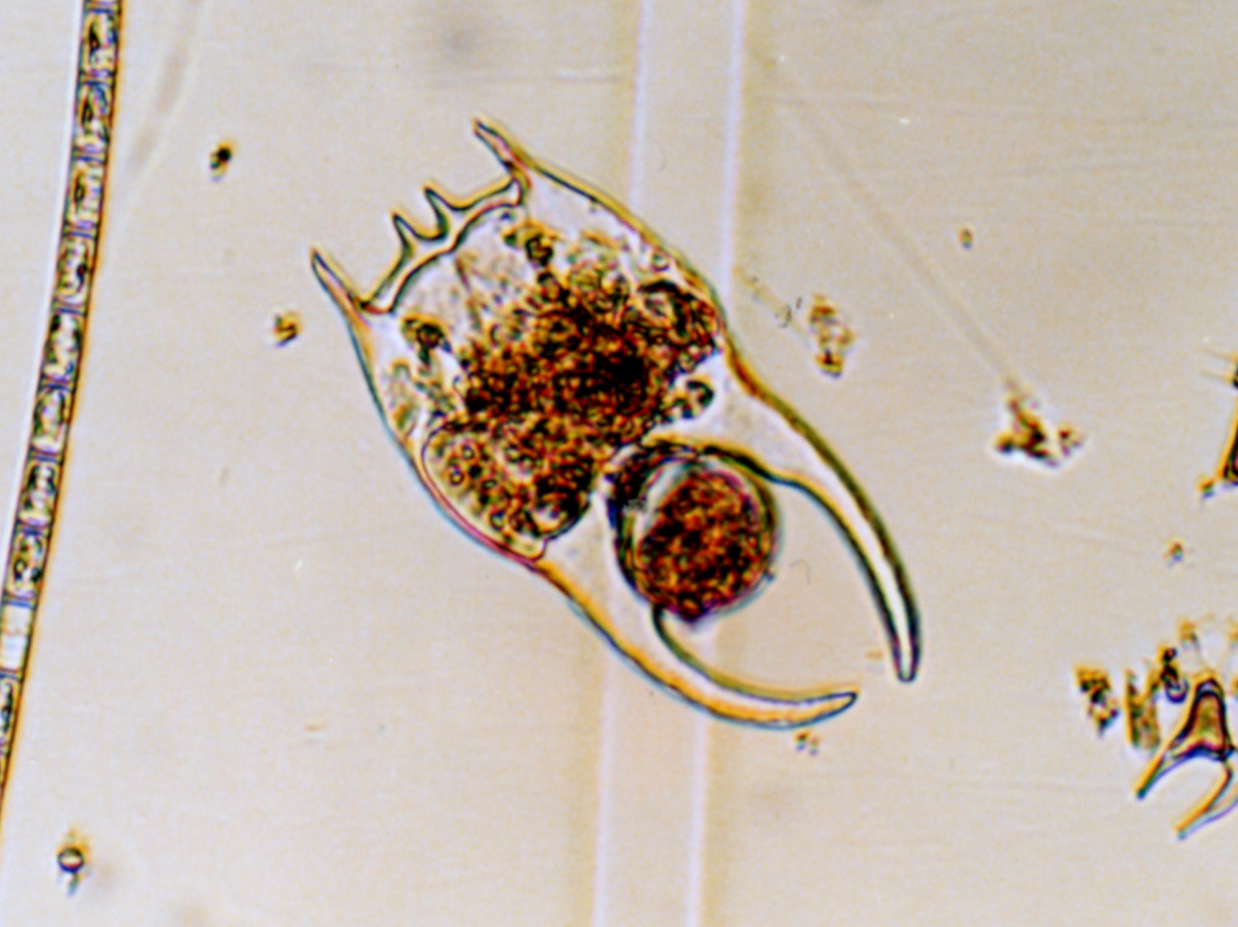 ウシロヅノツボワムシ