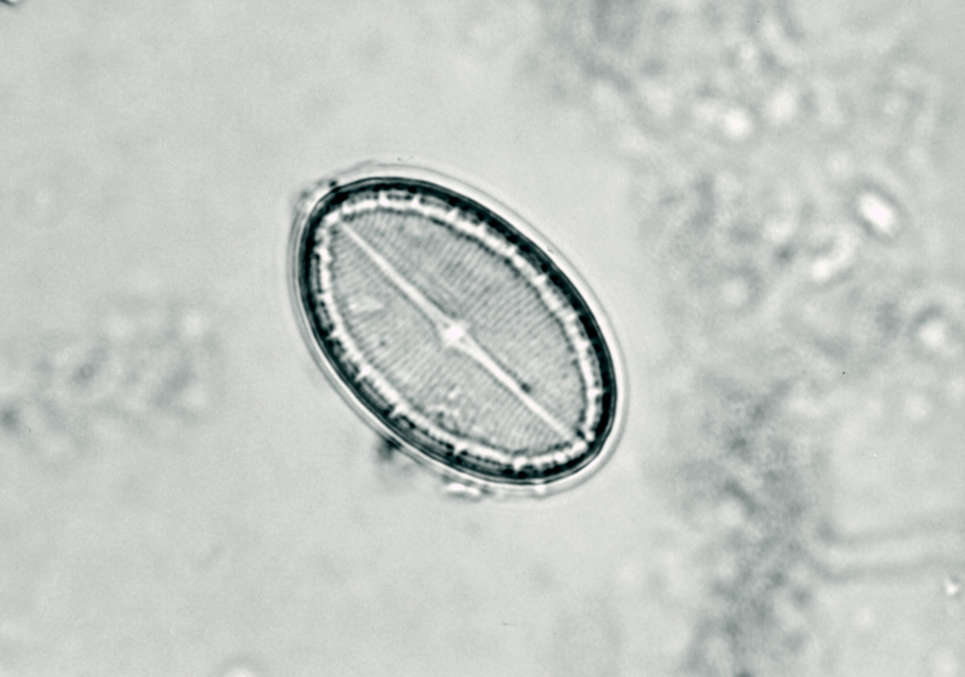 コメツブケイソウ