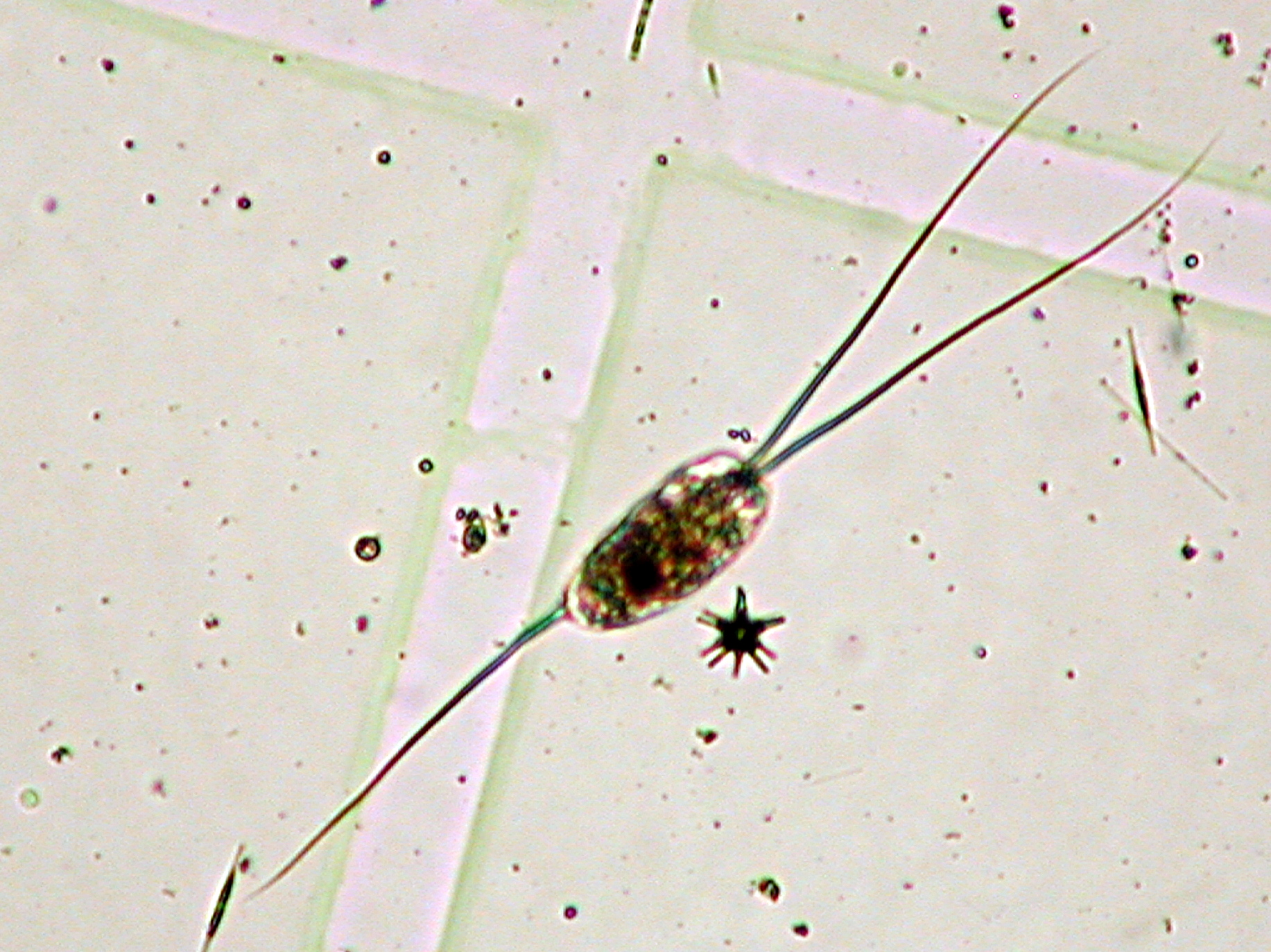 ミツウデワムシ属の一種