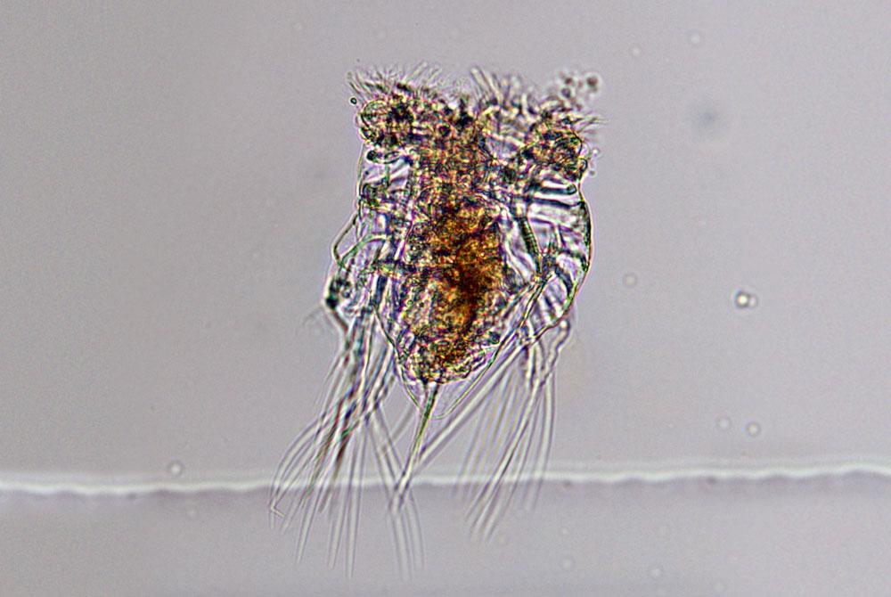 ミジンコワムシ