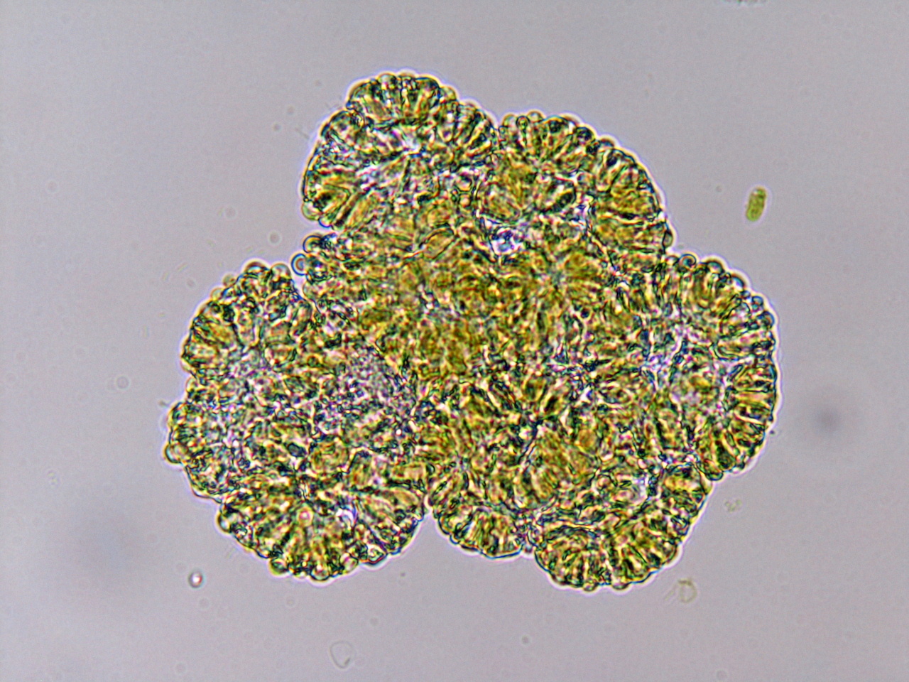 ボツリオコックス ブラウニー