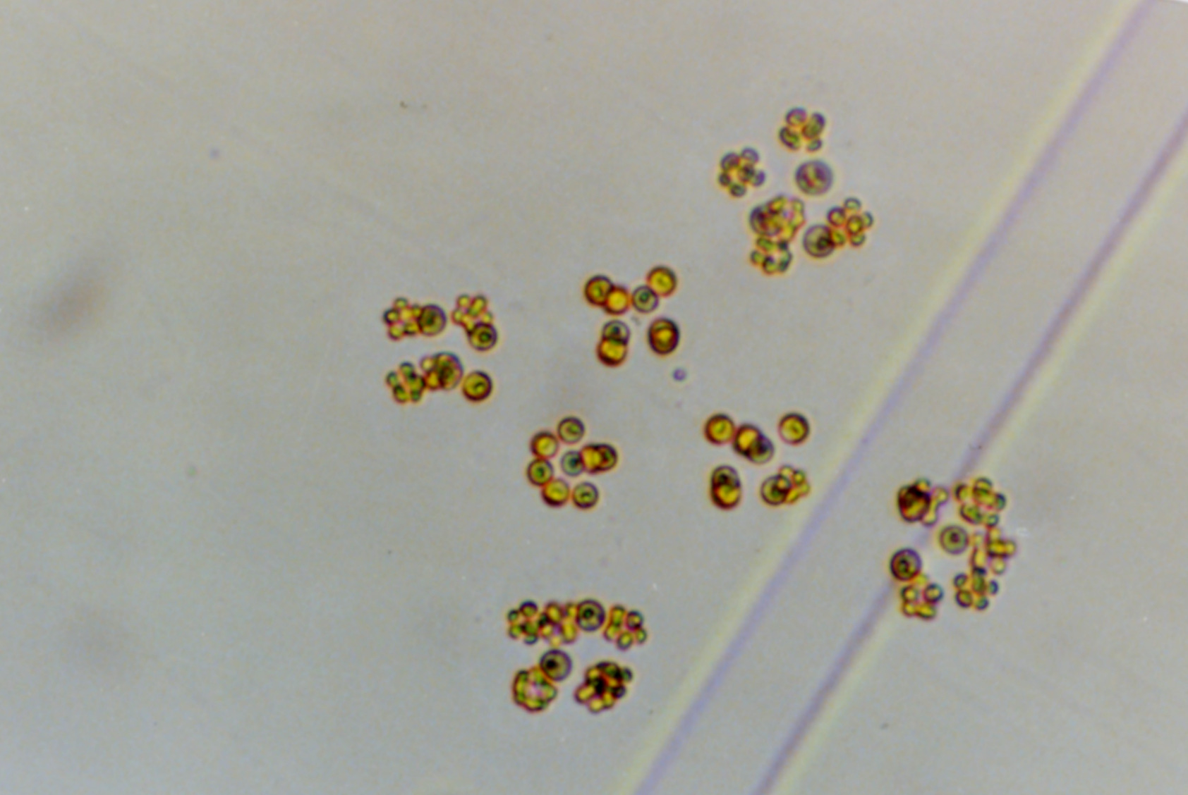 スフェロキスチス シュローテリ