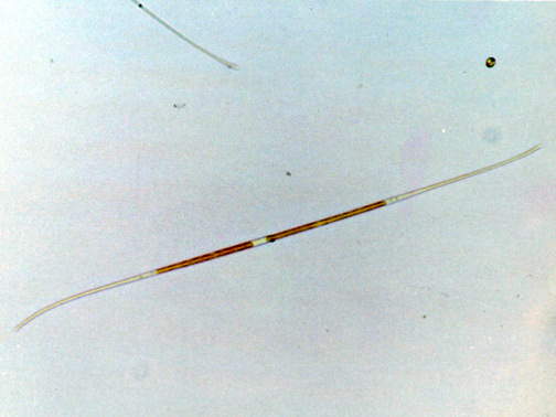 クロステリウム アキクラーレ(ミカヅキモ)