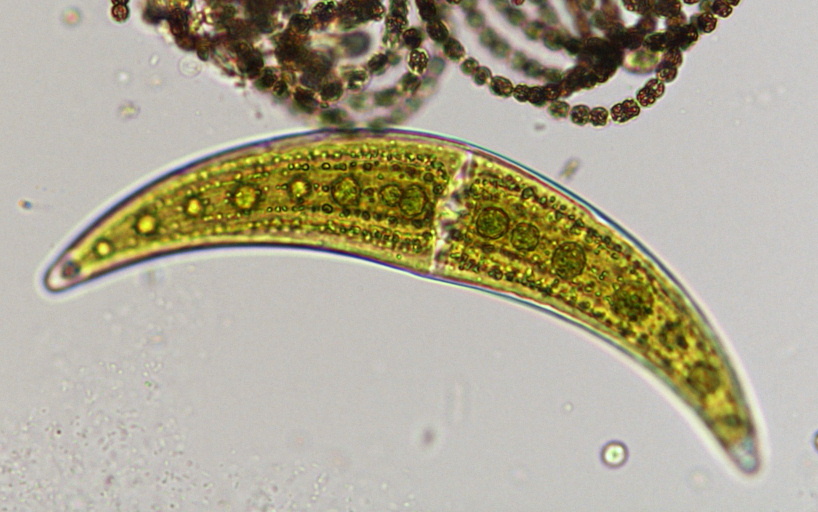 クロステリウム モニリフェルム(ミカヅキモ)