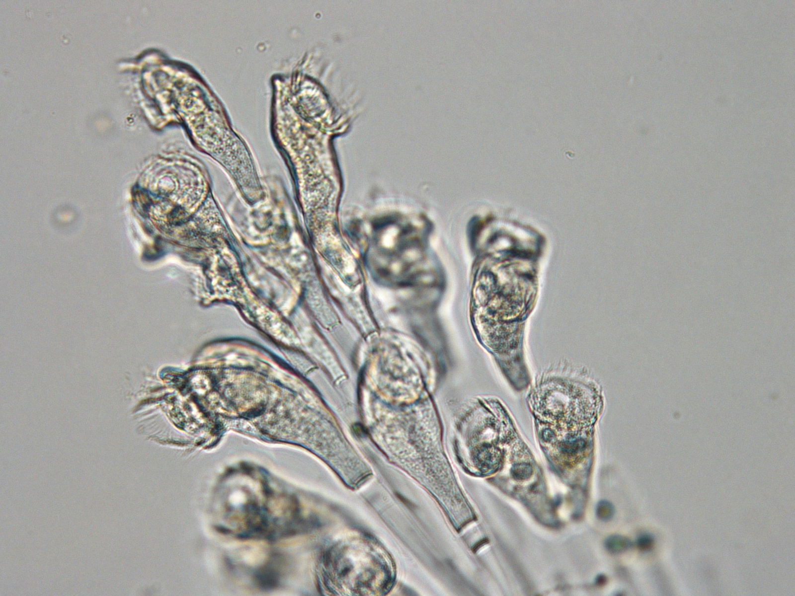 エピスティリス