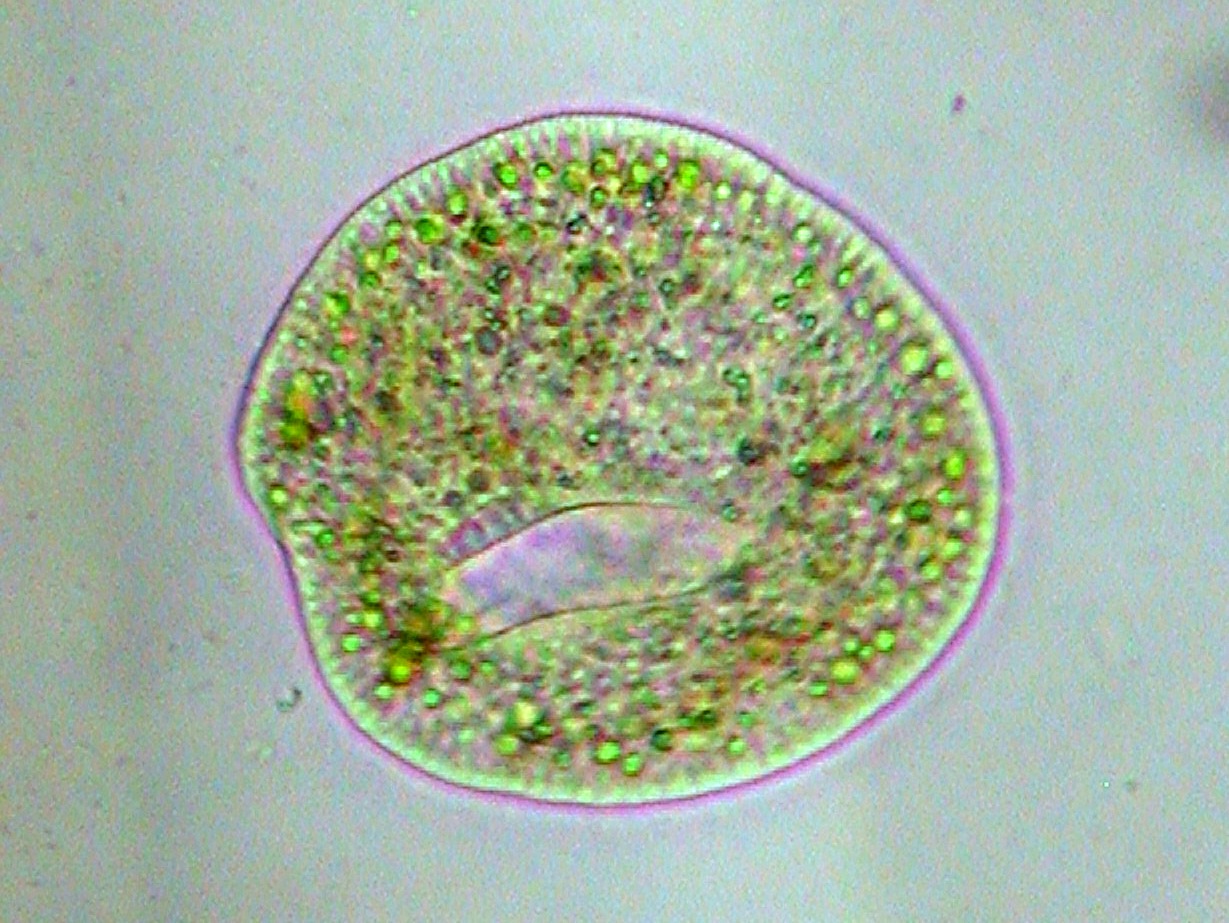 ストケシア ベルナリス