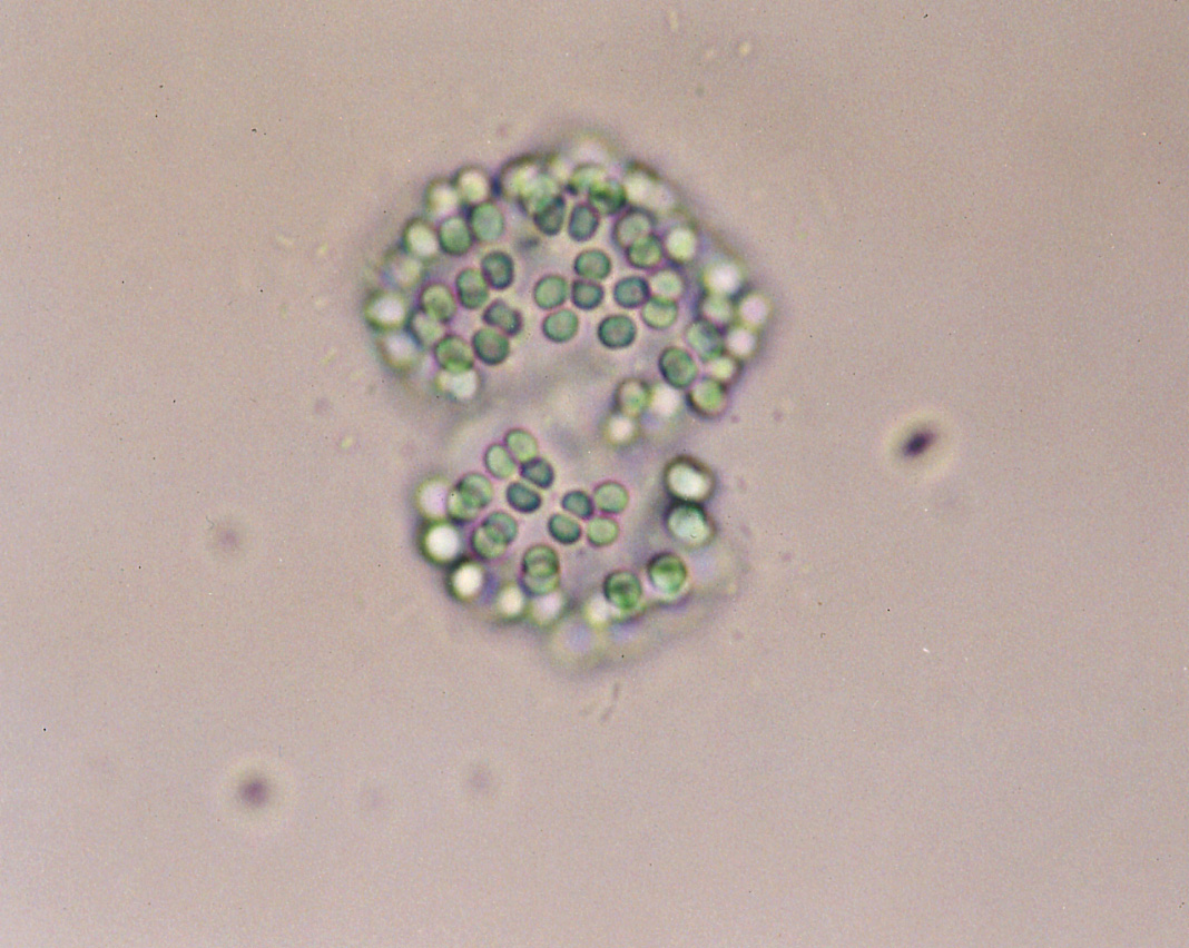 ゴンフォスフェリアラクトリス