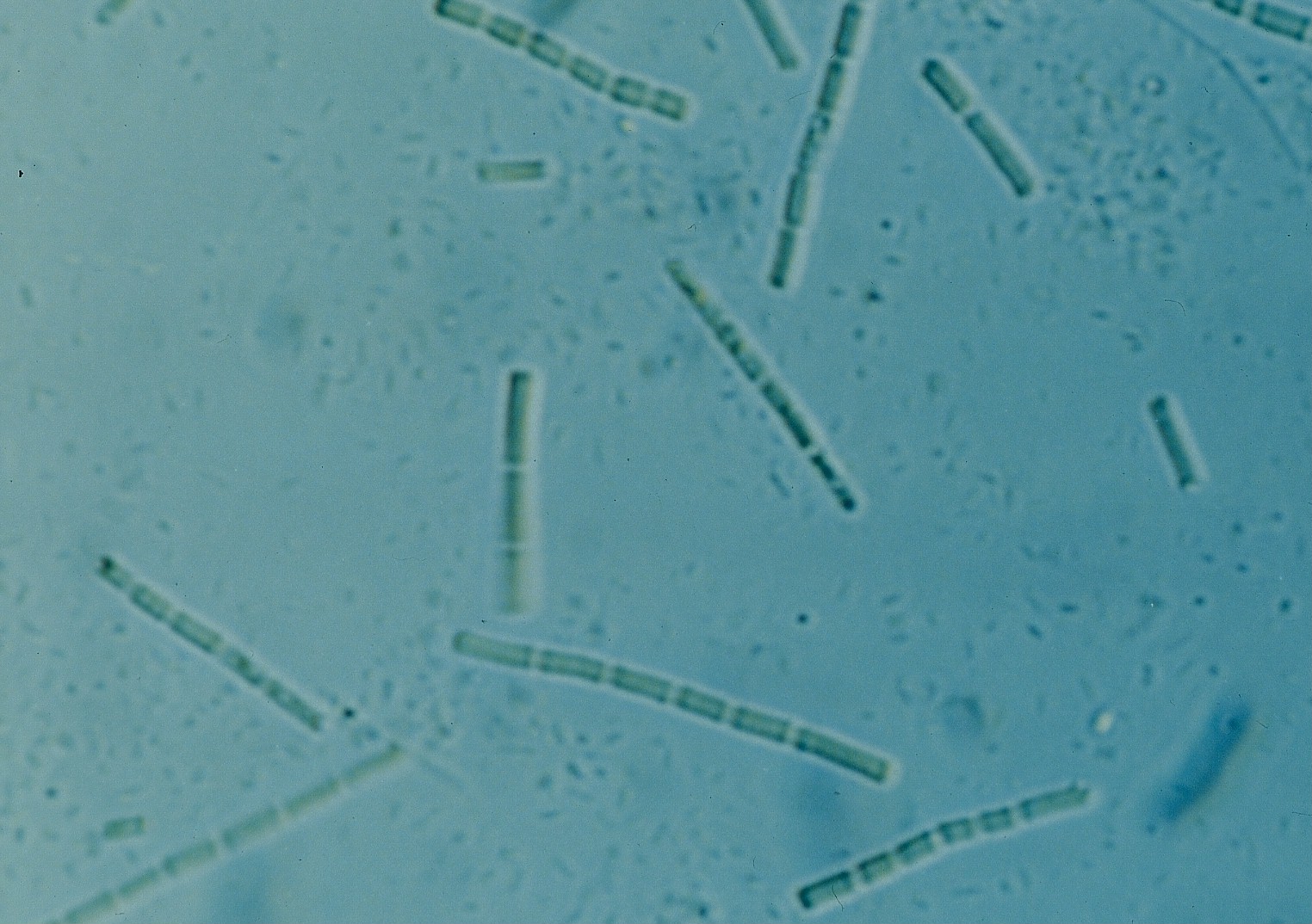 フォルミディウム テヌエ