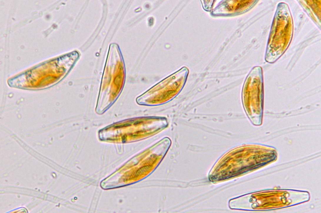 クチビルケイソウ