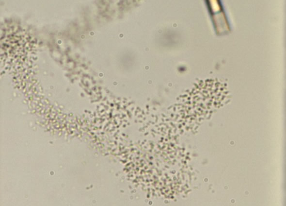 アファノテーケ クラスラータ